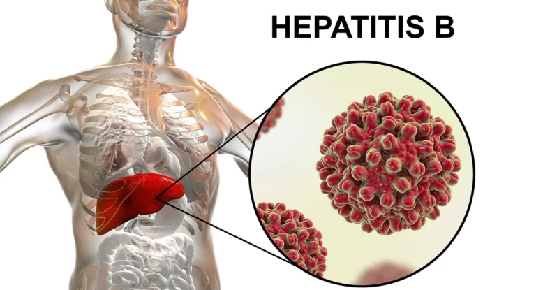 Hepatit B Nedir, Nasıl Bulaşır, Belirtileri Nelerdir
